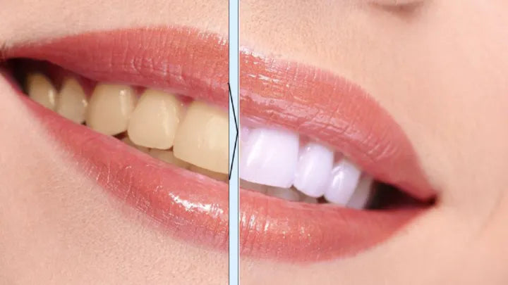 Instant Teeth Whitening Pen