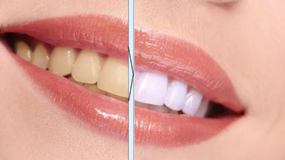 Instant Teeth Whitening Pen